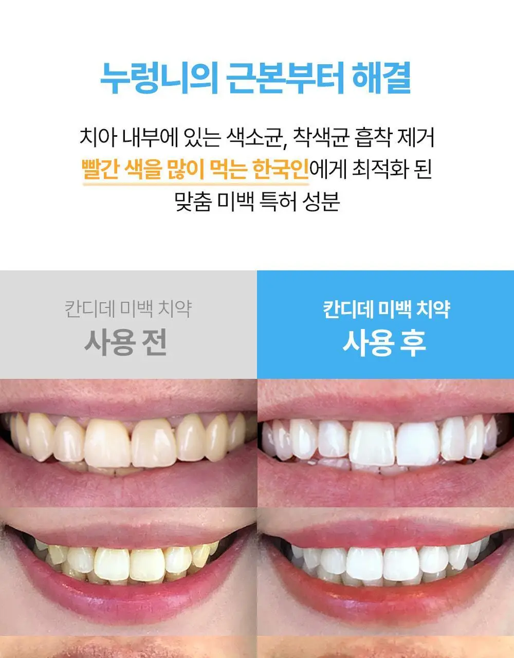 [치아미백] 칸디데 화이트케어 치약 100g 상세페이지 13